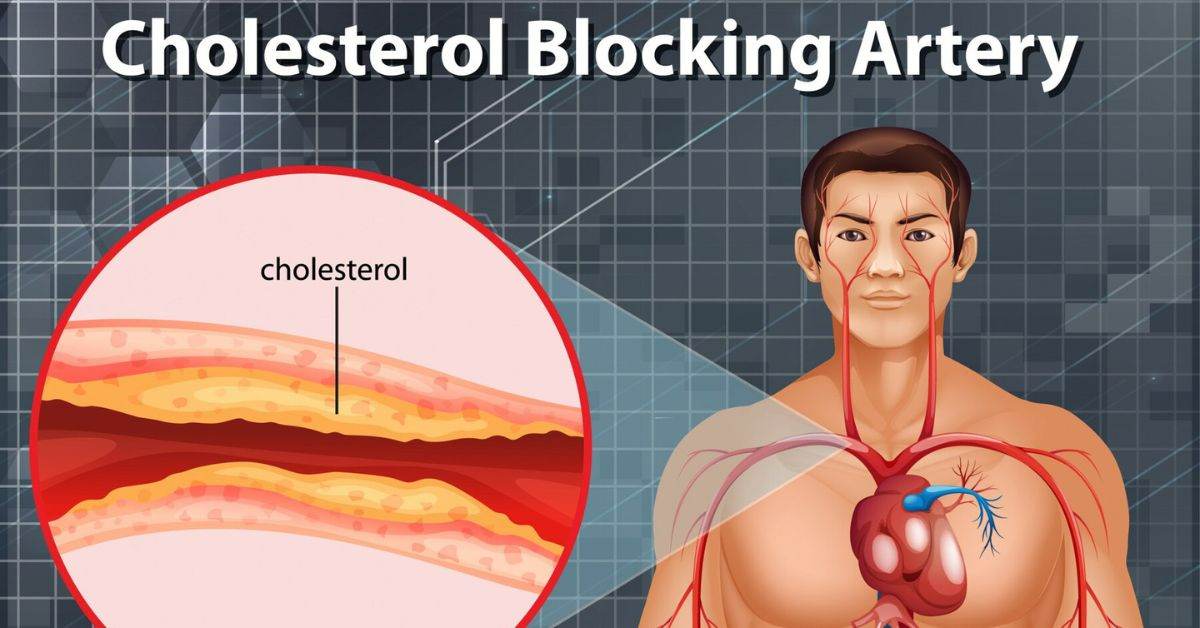 controls cholesterol level