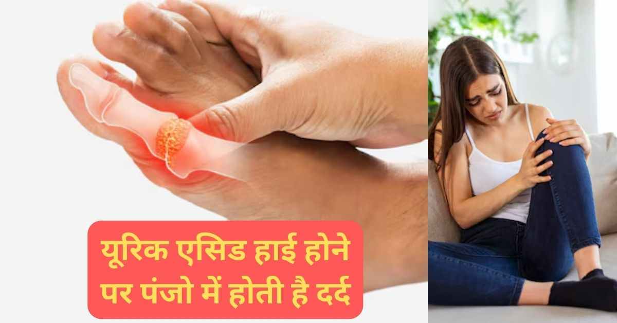 How to Get Rid of High Uric Acid